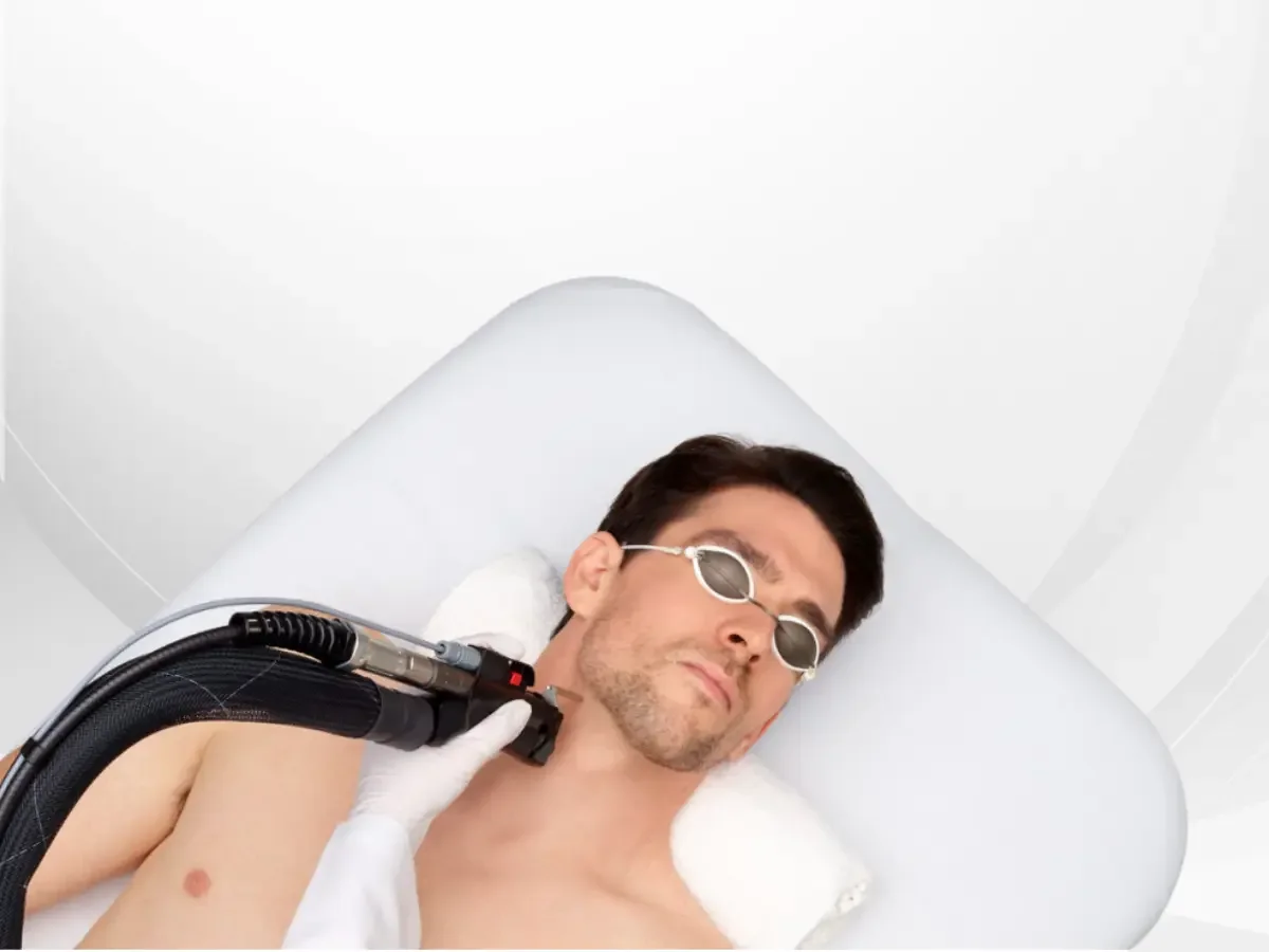 A client wearing protective eyewear during an Elite iQ laser session